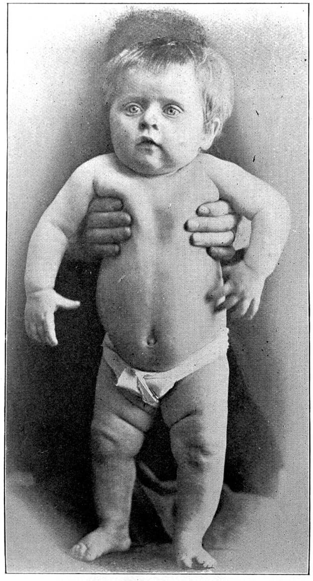 Ein Schwarz-Weiß-Foto eines Babys, das mit den Händen auf der Brust vor einem weißen Hintergrund steht, mit Text unten.